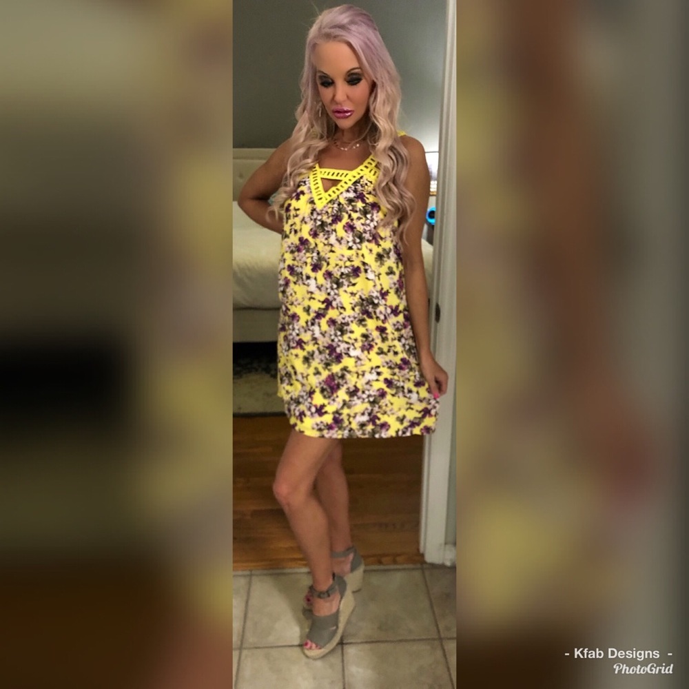 🌞LAST 1! 💕Cut Out Detail Floral Tunic Dress! - Picture 4 of 4